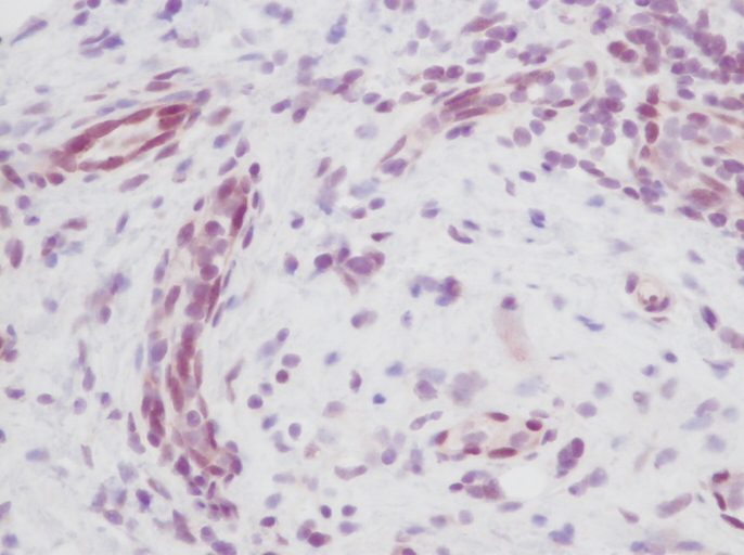 IHC of MIA antibody LS-C104285