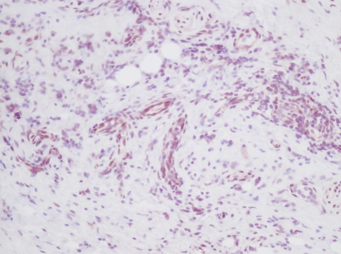 IHC of MIA antibody LS-C104285