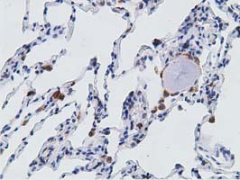 IHC of paraffin-embedded Human lung tissue using anti-PECR mouse monoclonal antibody. (Dilution 1:50).