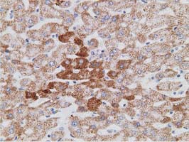 IHC of paraffin-embedded Human liver tissue using anti-PECR mouse monoclonal antibody. (Dilution 1:50).
