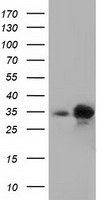 HEK293T cells were transfected with the pCMV6-ENTRY control (Left lane) or pCMV6-ENTRY PECR (Right lane) cDNA for 48 hrs and lysed. Equivalent amounts of cell lysates (5 ug per lane) were separated by SDS-PAGE and immunoblotted with anti-PECR.