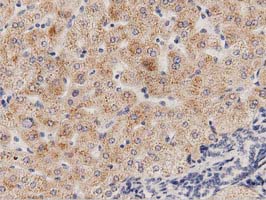IHC of paraffin-embedded Human liver tissue using anti-PECR mouse monoclonal antibody. (Dilution 1:50).