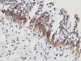 IHC of paraffin-embedded Human bladder tissue using anti-PECR mouse monoclonal antibody. (Dilution 1:50).