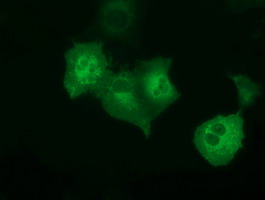 Anti-PECR mouse monoclonal antibody immunofluorescent staining of COS7 cells transiently transfected by pCMV6-ENTRY PECR.