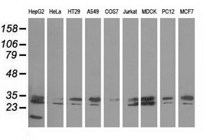 Western blot of extracts (35 ug) from 9 different cell lines by using anti-PECR monoclonal antibody.