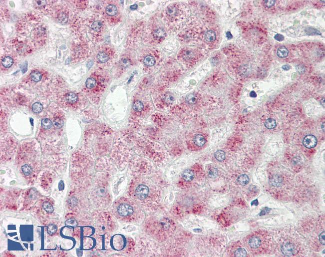 Human Liver: Formalin-Fixed, Paraffin-Embedded (FFPE)