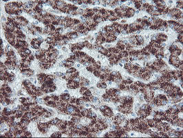 IHC of paraffin-embedded Human liver tissue using anti-PECR mouse monoclonal antibody. (Heat-induced epitope retrieval by 10mM citric buffer, pH6.0, 100C for 10min).