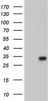 HEK293T cells were transfected with the pCMV6-ENTRY control (Left lane) or pCMV6-ENTRY PECR (Right lane) cDNA for 48 hrs and lysed. Equivalent amounts of cell lysates (5 ug per lane) were separated by SDS-PAGE and immunoblotted with anti-PECR.