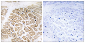 IHC of paraffin-embedded human heart tissue, using MIA Antibody. The picture on the right is treated with the synthesized peptide.