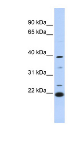 PEF1 antibody LS-C112206 Western blot of 721_B cell lysate.