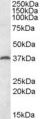 MEST antibody (0.2 ug/ml) staining of Mouse Testis lysate (35 ug protein in RIPA buffer). Primary incubation was 1 hour. Detected by chemiluminescence.