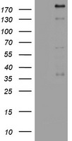 HEK293T cells were transfected with the pCMV6-ENTRY control (Left lane) or pCMV6-ENTRY ${SYMBOL} (${RC_SKU}, Right lane) cDNA for 48 hrs and lysed. Equivalent amounts of cell lysates (5 ug per lane) were separated by SDS-PAGE and immunoblotted with anti-${SYMBOL}.