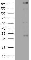 HEK293T cells were transfected with the pCMV6-ENTRY control (Left lane) or pCMV6-ENTRY PEG3 (Right lane) cDNA for 48 hrs and lysed. Equivalent amounts of cell lysates (5 ug per lane) were separated by SDS-PAGE and immunoblotted with anti-PEG3.