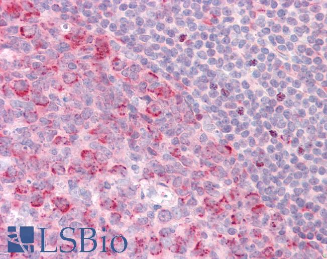 Anti-PELI1 / Pellino 1 antibody IHC staining of human tonsil. Immunohistochemistry of formalin-fixed, paraffin-embedded tissue after heat-induced antigen retrieval.
