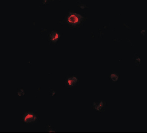 Immunofluorescence of Pellino 1 in HepG2 cells with Pellino 1 antibody at 20 ug/ml.