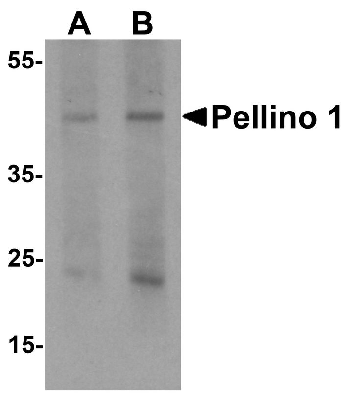 Western blot analysis of Pellino 1 in human liver tissue lysate with Pellino 1 antibody at (A) 1 and (B) 2 ug/ml.