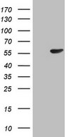 HEK293T cells were transfected with the pCMV6-ENTRY control (Left lane) or pCMV6-ENTRY PELI1 (Right lane) cDNA for 48 hrs and lysed. Equivalent amounts of cell lysates (5 ug per lane) were separated by SDS-PAGE and immunoblotted with anti-PELI1.