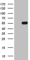 HEK293T cells were transfected with the pCMV6-ENTRY control (Left lane) or pCMV6-ENTRY PELI1 (Right lane) cDNA for 48 hrs and lysed. Equivalent amounts of cell lysates (5 ug per lane) were separated by SDS-PAGE and immunoblotted with anti-PELI1 (1:2000).