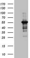 HEK293T cells were transfected with the pCMV6-ENTRY control (Left lane) or pCMV6-ENTRY PELI1 (Right lane) cDNA for 48 hrs and lysed. Equivalent amounts of cell lysates (5 ug per lane) were separated by SDS-PAGE and immunoblotted with anti-PELI1.