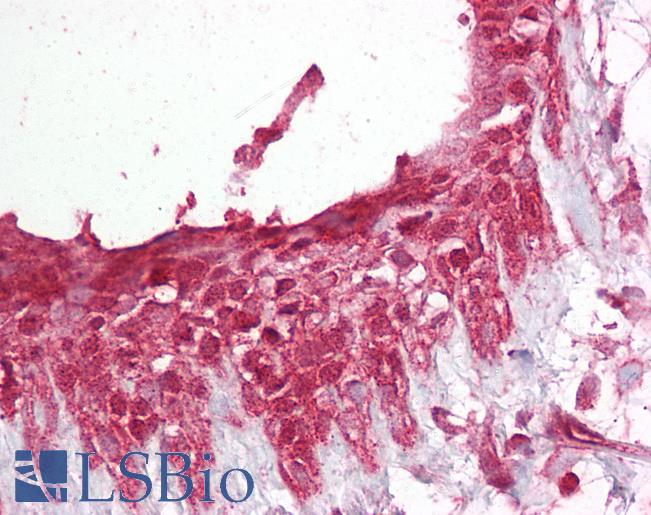 Anti-PELI1 antibody IHC of human breast. Immunohistochemistry of formalin-fixed, paraffin-embedded tissue after heat-induced antigen retrieval. Antibody LS-B6497 dilution 1:100.