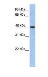 HepG2 cell lysate. Antibody concentration: 1.0 ug/ml. Gel concentration: 12%.