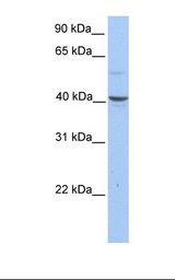 HepG2 cell lysate. Antibody concentration: 1.0 ug/ml. Gel concentration: 12%.
