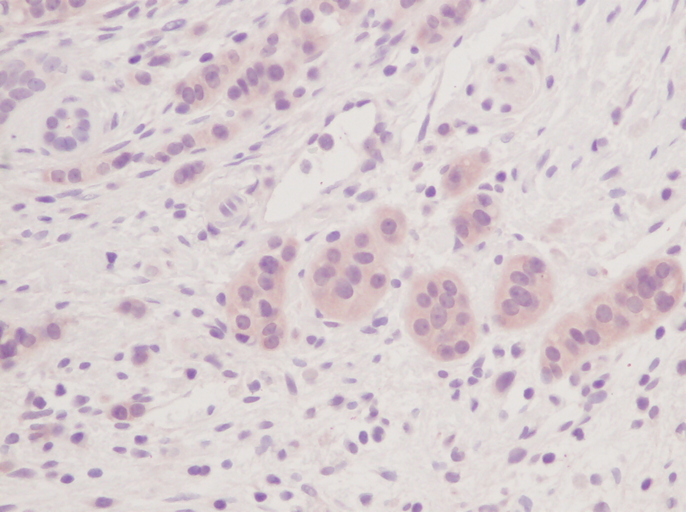IHC of MIA2 antibody LS-C104283