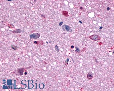 Anti-MCHR1 antibody LS-A1533 IHC of human brain. Immunohistochemistry of formalin-fixed, paraffin-embedded tissue after heat-induced antigen retrieval.