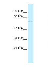 PEPD antibody LS-C145869 Western blot of Small Intestine lysate. Antibody concentration 1 ug/ml.