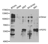 Western blot analysis of extracts of various cell lines, using PEPD antibody.