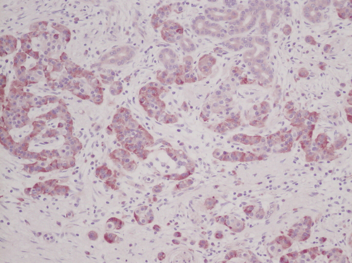 IHC of MIA2 antibody LS-C104283