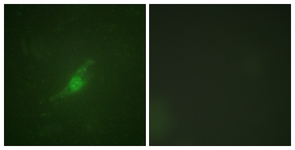 Immunofluorescence of NIH-3T3 cells, using Period Circadian Protein 2 Antibody. The sample on the right was incubated with synthetic peptide.