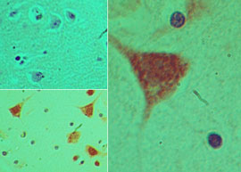 IHC of PER2 in formalin-fixed, paraffin-embedded human brain tissue using an isotype control (top left) and LS-C148630 (bottom left, right) at 5 ug/ml.