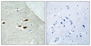 IHC of paraffin-embedded human brain, using Period Circadian Protein 2 (Phospho-Ser662) Antibody. The sample on the right was incubated with synthetic peptide.
