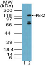 Western blot of PER2 in human brain lysate using 1) preimmune sera at 1:5000 and 2) peptide affinity purified LS-C148562 at 2.0 ug/ml. Goat anti-rabbit Ig HRP secondary antibody, and PicoTect ECL substrate solution, were used for this test.