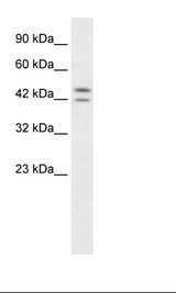 Jurkat Cell Lysate