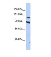 Western blot of Human HepG2. PER3 antibody dilution 1.0 ug/ml.