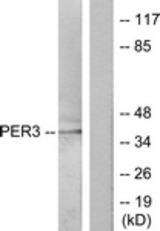 Western blot of extracts from Jurkat cells, treated with insulin 0.01U/ml 15', using PER3 Antibody. The lane on the right is treated with the synthesized peptide.