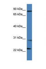 MIA2 antibody LS-C135871 Western blot of 1 Cell lysate. Antibody concentration 1 ug/ml.