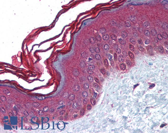 Anti-PERP antibody IHC of human skin. Immunohistochemistry of formalin-fixed, paraffin-embedded tissue after heat-induced antigen retrieval. Antibody LS-B1389 concentration 5 ug/ml.