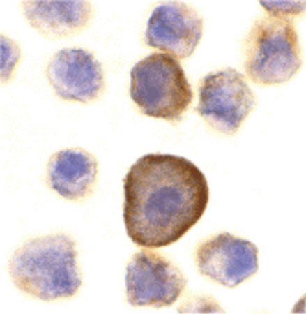 Immunocytochemistry of PERP in A431 cells with PERP antibody at 10 ug/ml.