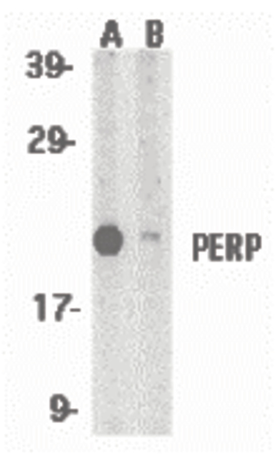 Western blot of PERP expression in A431 whole cell lysates in the absence (A) and presence (B) of blocking peptide with PERP antibody at 1 ug /ml.