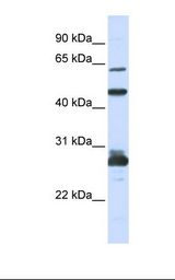 Hela cell lysate. Antibody concentration: 1.0 ug/ml. Gel concentration: 12%.