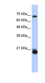 CHCHD4 / MIA40 antibody LS-C102407 Western blot of Transfected 293T cell lysate.