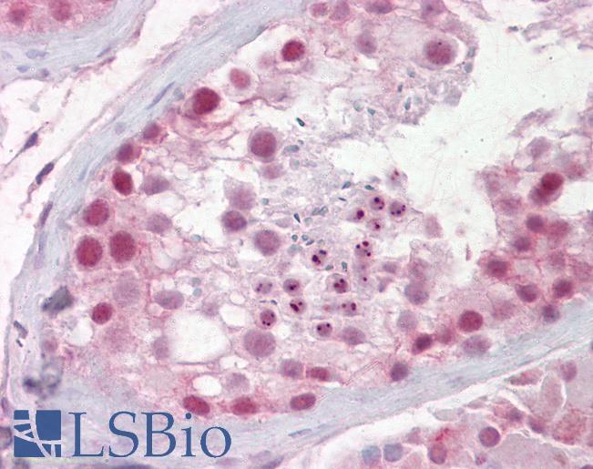 Anti-PES1 antibody IHC of human testis. Immunohistochemistry of formalin-fixed, paraffin-embedded tissue after heat-induced antigen retrieval. Antibody LS-B6528 concentration 2.5 ug/ml.