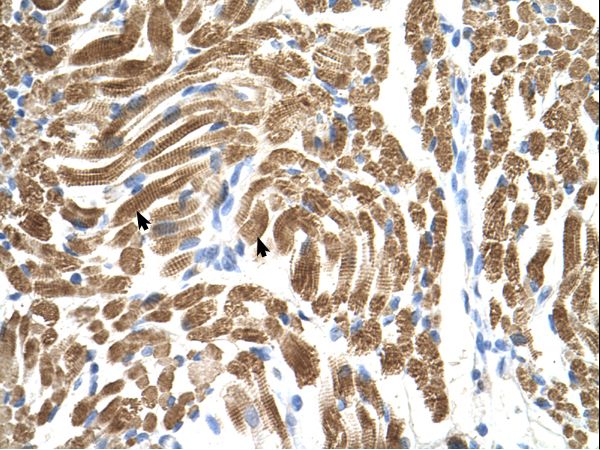 PEX10 antibody LS-C80573 was used in IHC to stain formalin-fixed, paraffin-embedded human muscle.