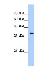Transfected 293T cell lysate. Antibody concentration: 0.25 ug/ml. Gel concentration: 12%.