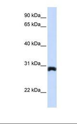 Placenta lysate. Antibody concentration: 1.0 ug/ml. Gel concentration: 12%.
