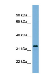 PEX11A antibody LS-C116327 Western blot of OVCAR-3 cell lysate.