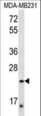 PEX11A Antibody western blot of MDA-MB231 cell line lysates (35 ug/lane). The PEX11A antibody detected the PEX11A protein (arrow).